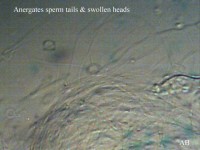 Bild 3:Nach Quetschen der Spermatheca quellen die fädigen Spermien heraus. Bei einigen sind die im Wasser angeschwollenen Köpfchen zu erkennen.