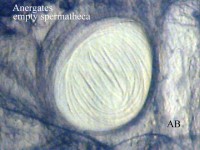 Bild 6: Stärker vergrößerte leere Spermatheca (vgl. Bild 2 in dieser Serie)