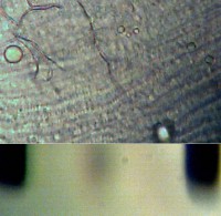 Bild 2: Muskelfasern bei Objektiv x25; Abstand der beiden Balken 1/10 mm.