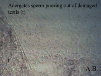Bild 2: Bei leichtem Druck tritt Sperma aus einem der Vesikel aus. Unter geringer Vergrößerung sind nur fädige Strukturen erkennbar.